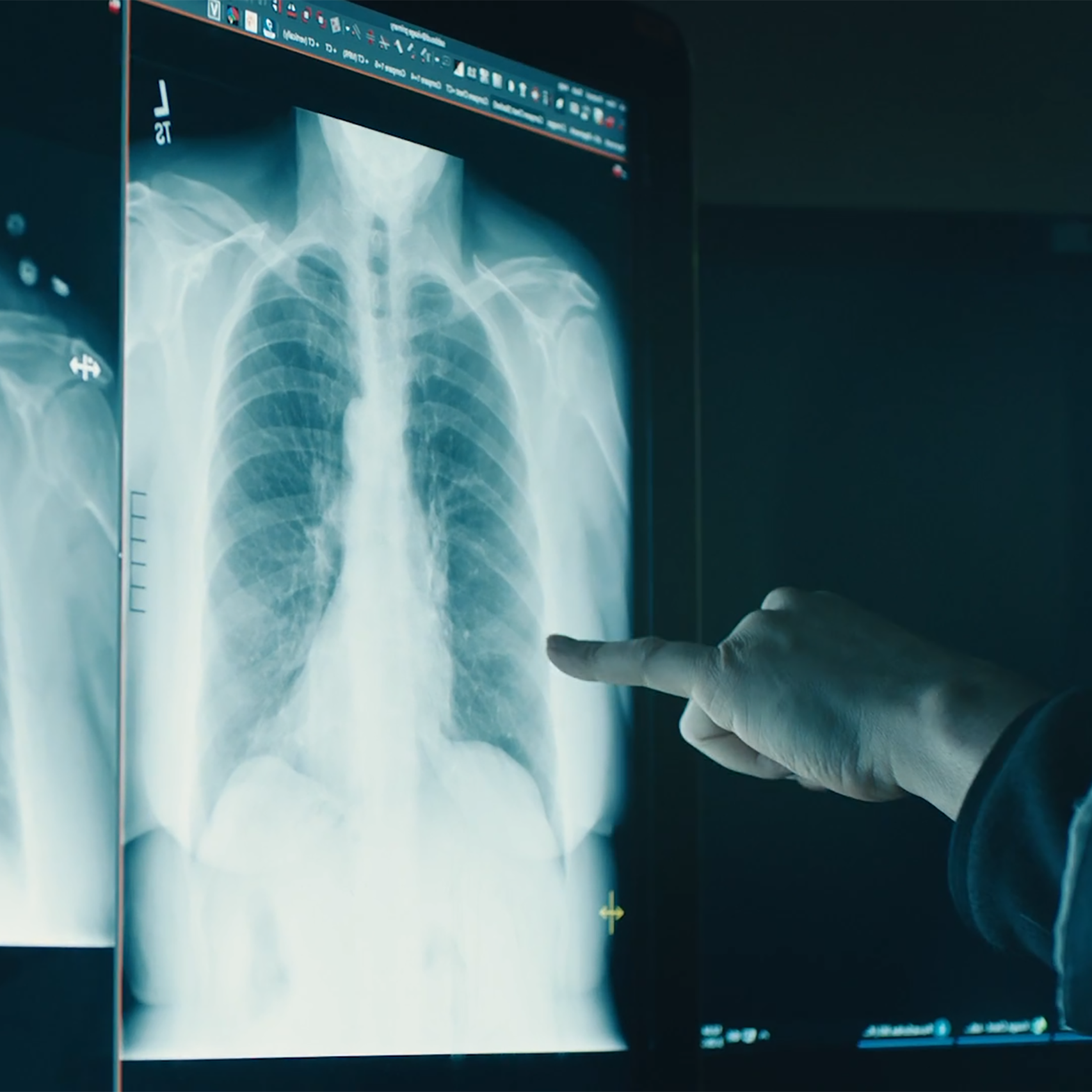Northwestern Medicine-kundehistoriebilde